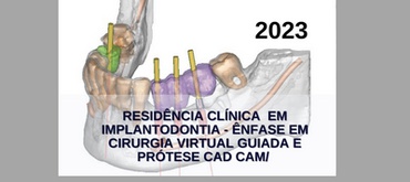 Residência Clínica  em Implantodontia - Ênfase em Cirurgia Virtual Guiada e prótese Cad Cam/      Matrículas Abertas!