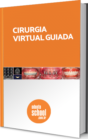 E-book Cirurgia Virtual Guiada